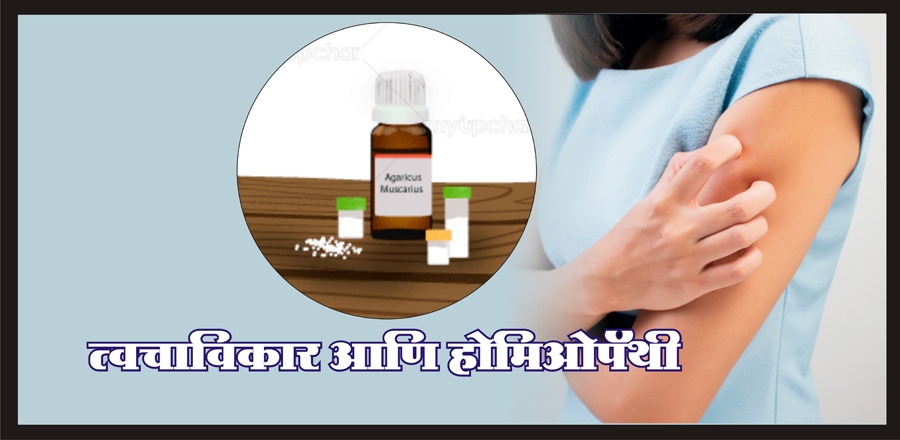 Homeopathy Treatment for 