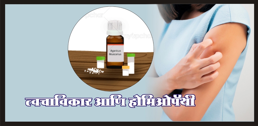 Homeopathy Treatment for Homeopathy Treatment for